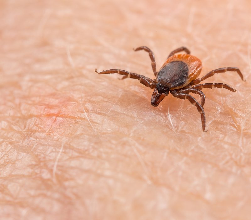 Tick on human skin, close-up view.